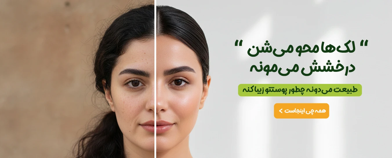 رفع لک پوست طبیعی